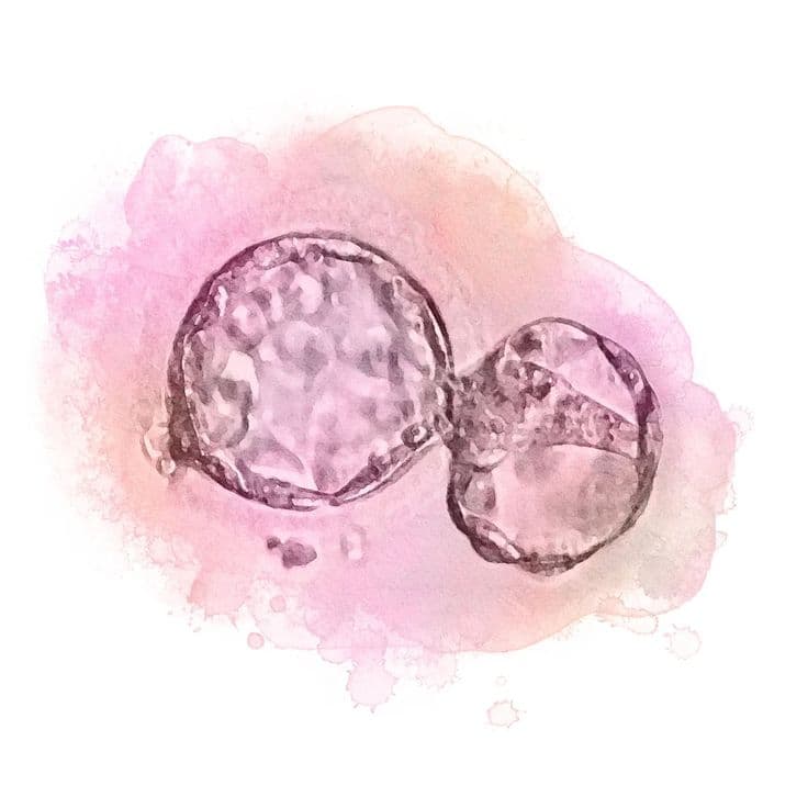 IVF Prediction